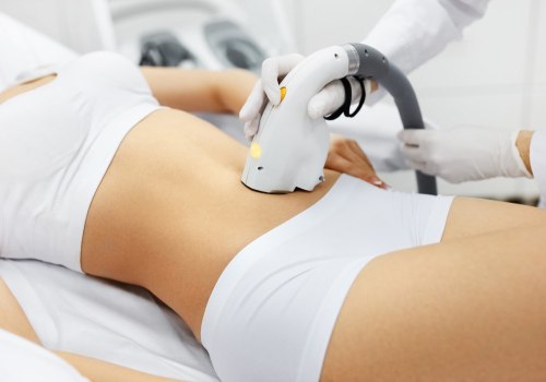 Does Laser Hair Removal Hurt? An Expert's Guide to Painless Hair Removal