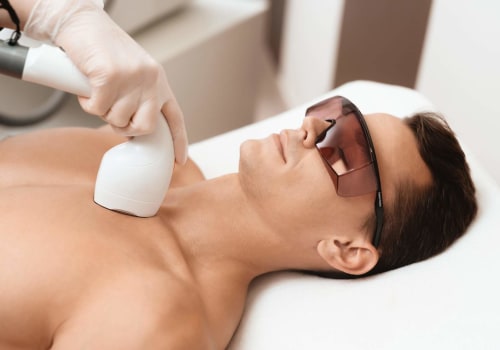 The Most Popular Areas for Laser Hair Removal