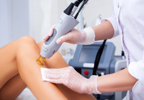 Can I Use a Professional Laser Hair Removal Machine After Electrolysis Treatments?