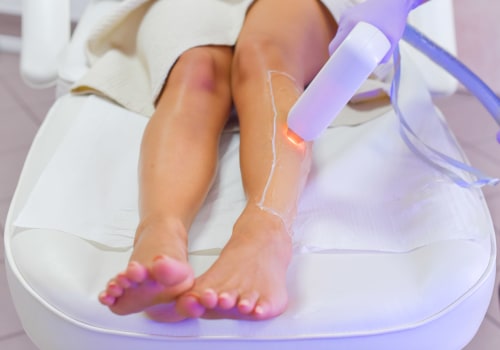 Is Laser Hair Removal Safe at Home? - An Expert's Perspective