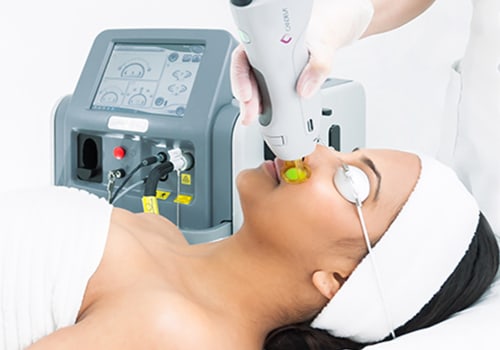 Can I Use a Professional Laser Hair Removal Machine on My Face? - A Comprehensive Guide